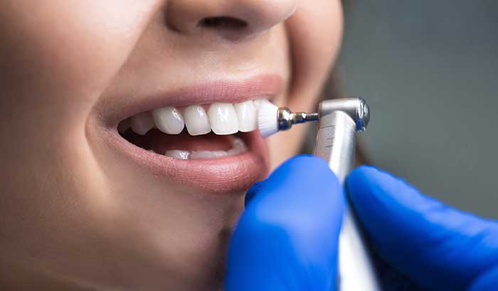 A woman getting her teeth whitened