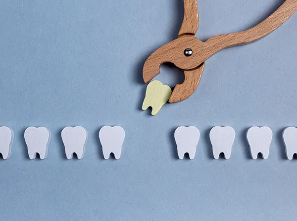 Row of wooden tooth shapes, one of which is being pulled out of the row by dental pliers at Parkside Dental in Murphy, TX 