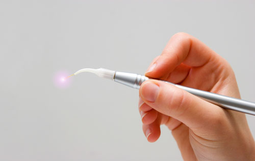 Single hand holding a dental laser tool.